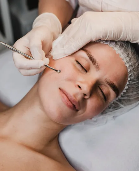 Skin Conditions